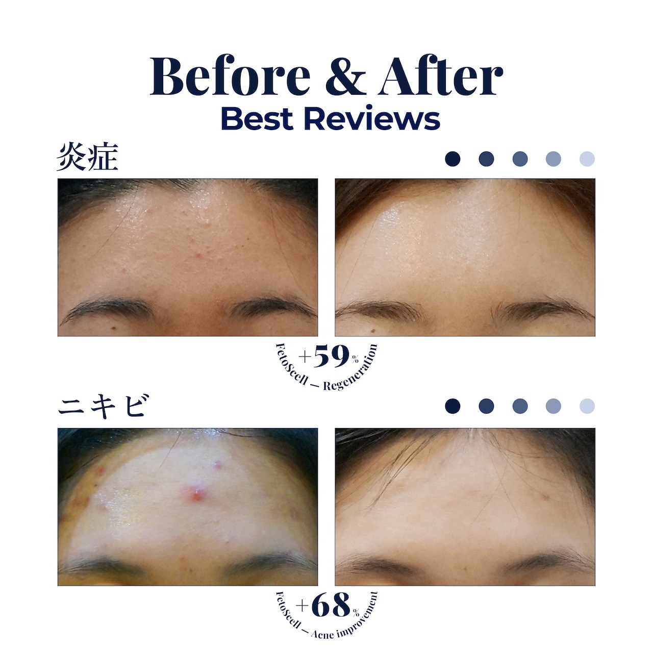 FetoScell(フェトセル)保湿ジェル フェトセル ジェル 保湿ジェル 30ml 【公式通販】