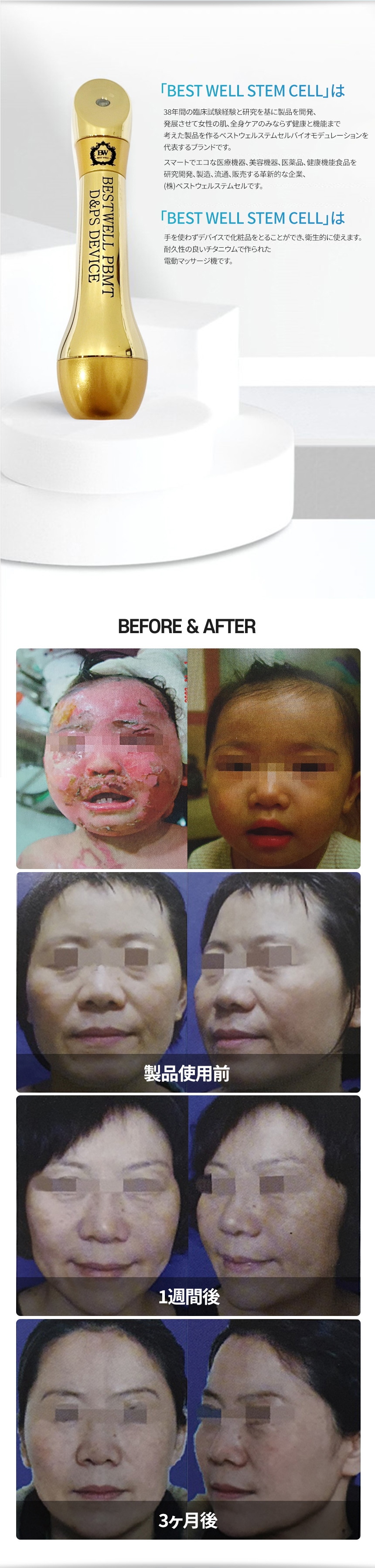 光セラピー BEST WELL PBMT D&PS デバイス / 美顔器